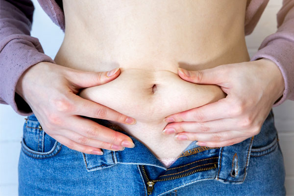 Significant Weight Loss